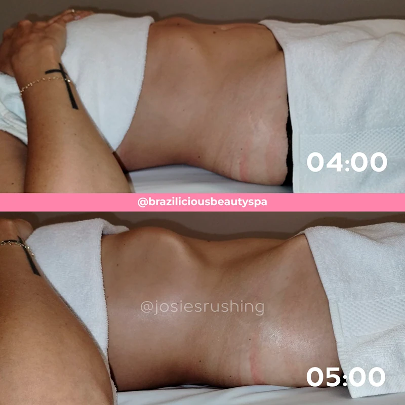 Before and After - Body
